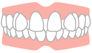 空隙歯列